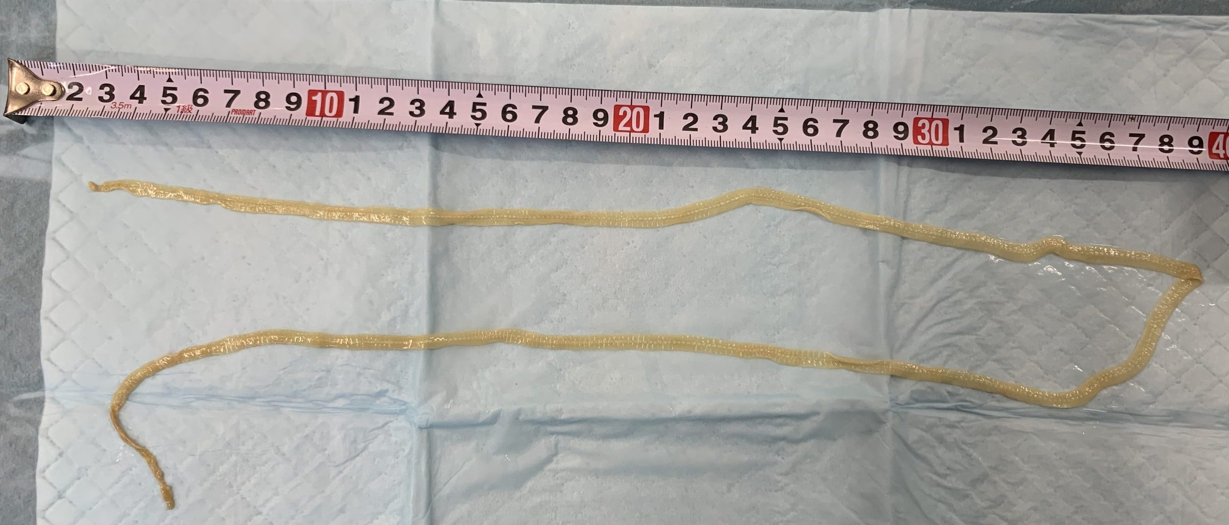 条虫症の危険因子は何ですか?